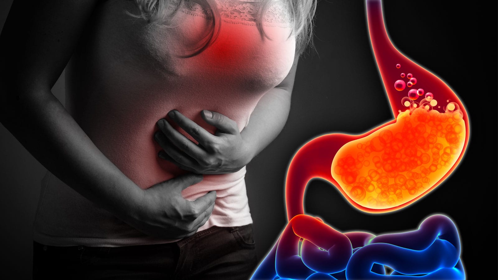 Is Acid Really The Cause Of Reflux Asa Andrew