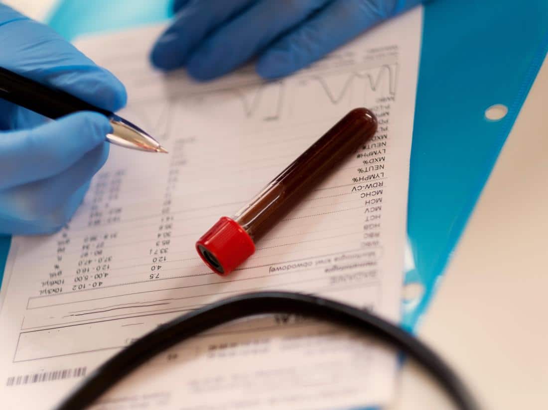 4 Blood Tests You Should Have Every Year Asa Andrew