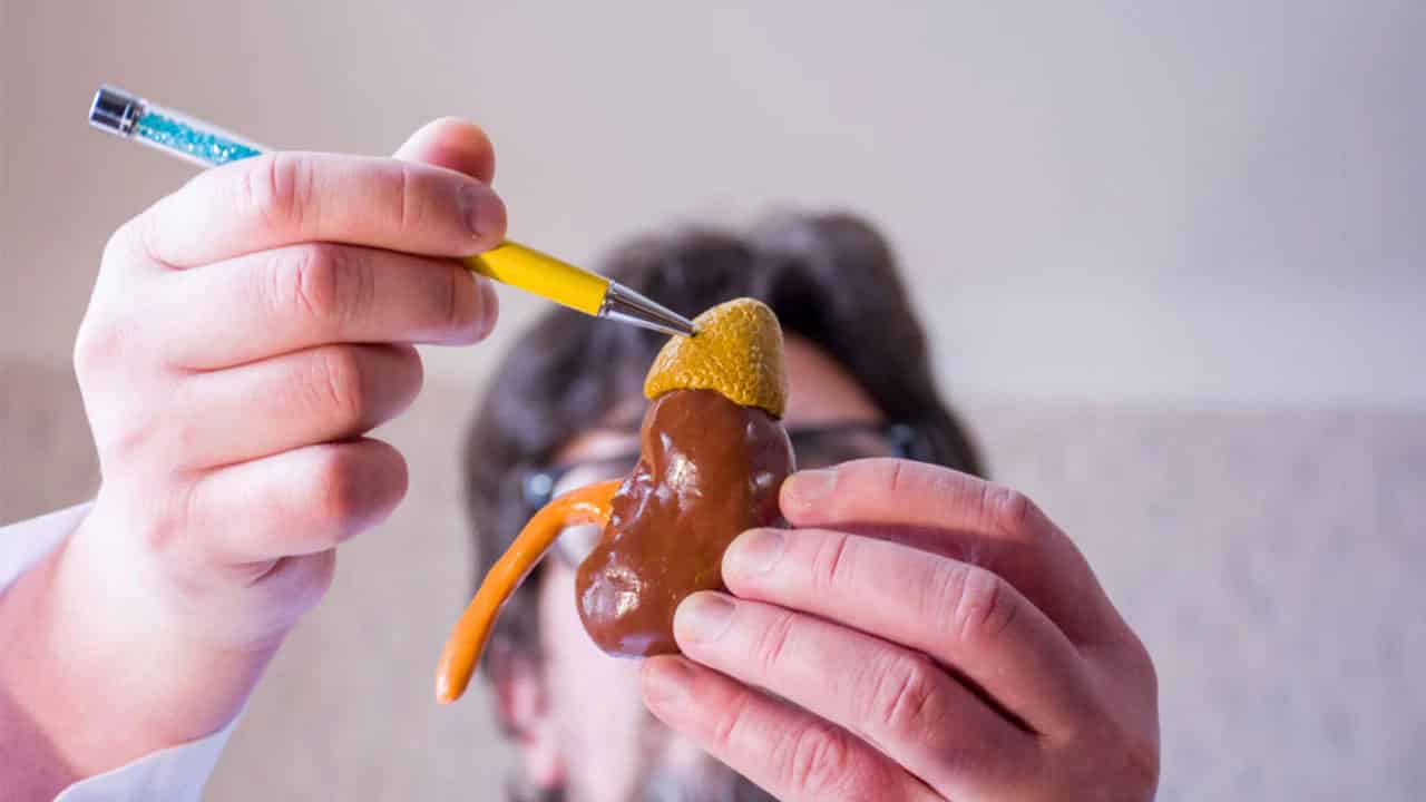 Addison's Disease Asa Andrew